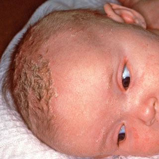 Baby Nasal Tweezers, Baby Booger picker Baby Ear Nose Navel Cleaner Clip  Tool, Q-Grips Ear