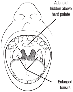Akshar_Pediatrics_Medical Conditions - Accordian 184