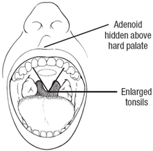 Akshar_Pediatrics_Medical Conditions - Accordian 190